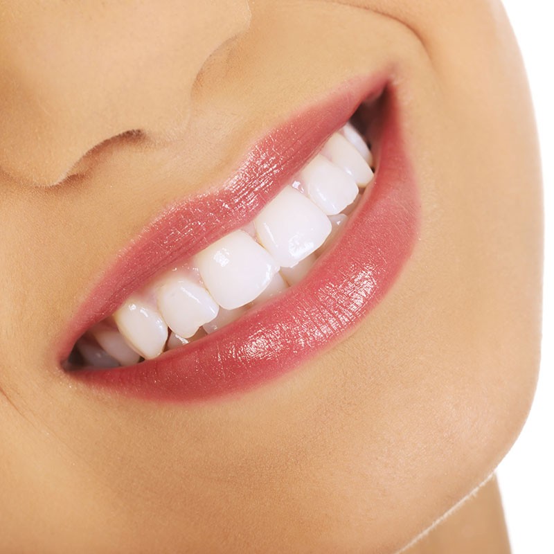 Professionelle Zahnreinigung Jennersdorf, Güssing