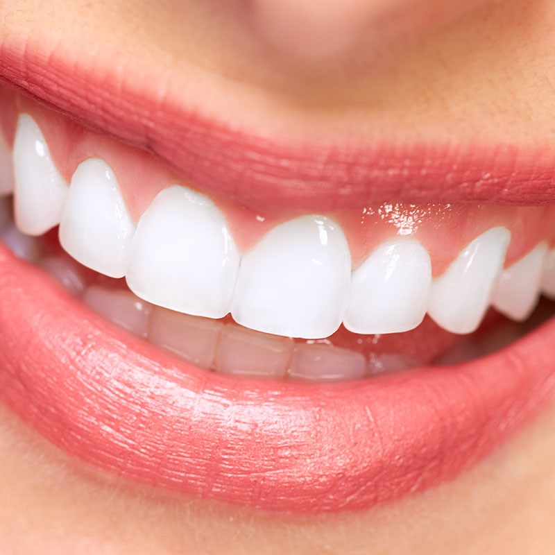 Zahnfleischbehandlung Jennersdorf, Güssing