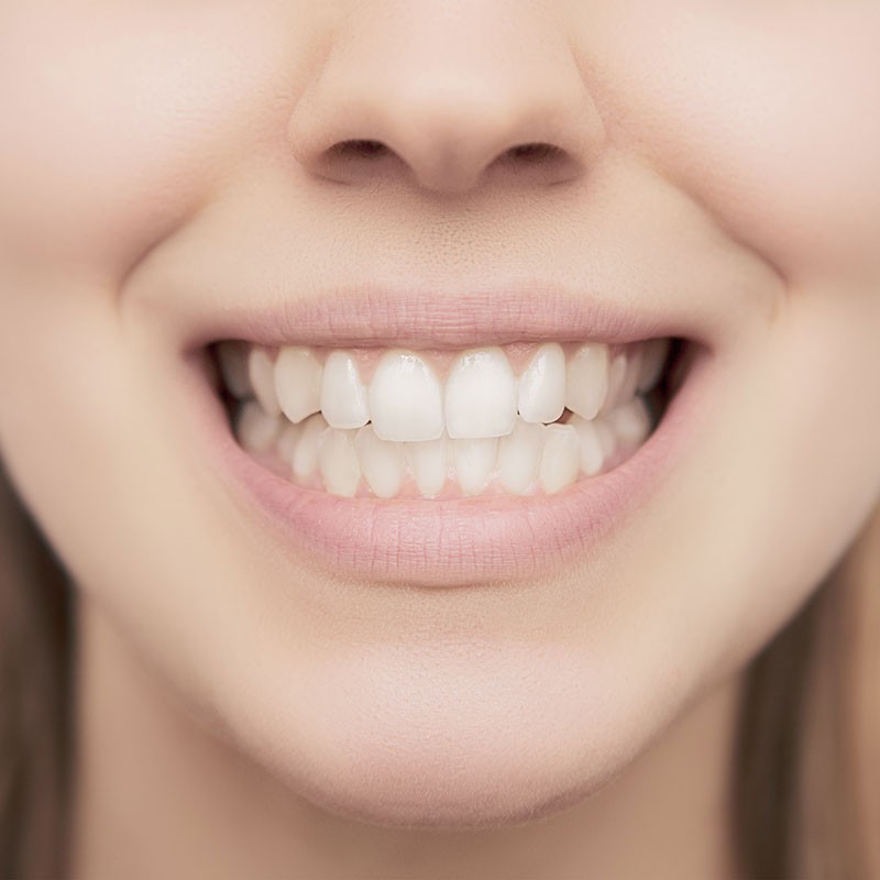 Infrarot-Kamera - Zahnarzt Güssing, Jennersdorf