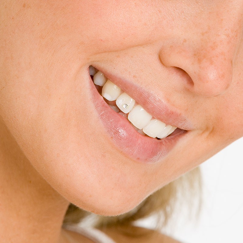 Zahnschmuck Jennersdorf Güssing